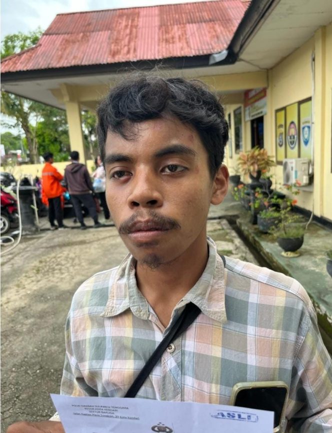 
 MS (21) menjadi korban dugaan penganiayaan oleh tiga oknum pegawai SPBU Baruga, Kendari. Foto: Istimewa