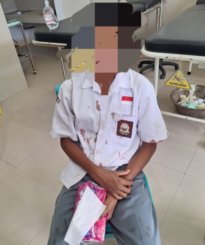 
 Siswa SMAN 1 Barangka yang diduga menjadi korban penganiayaan. Foto: Istimewa