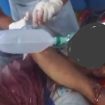 Korban tabrak lari di Konawe meninggal dunia. Foto: Istimewa