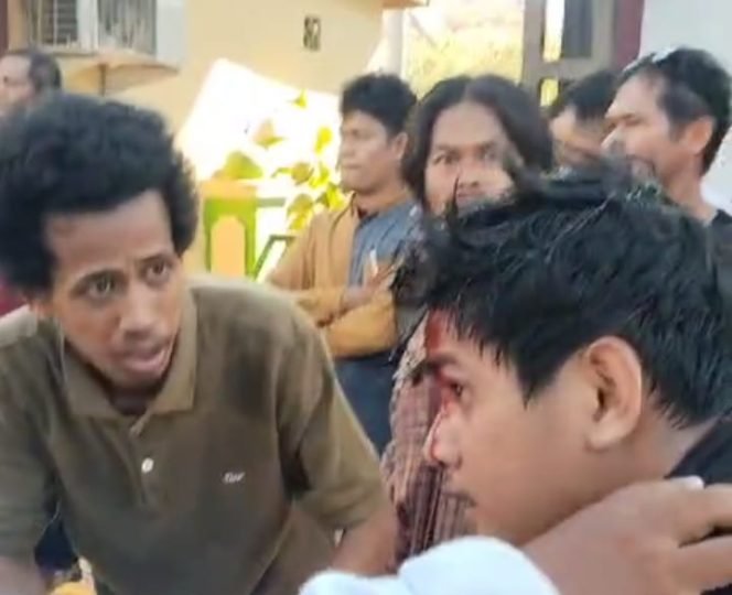 
 Salah satu massa aksi mengalami luka dibagian kepala diduga kena pukulan dari oknum pegawai PN Kendari. Foto: Istimewa