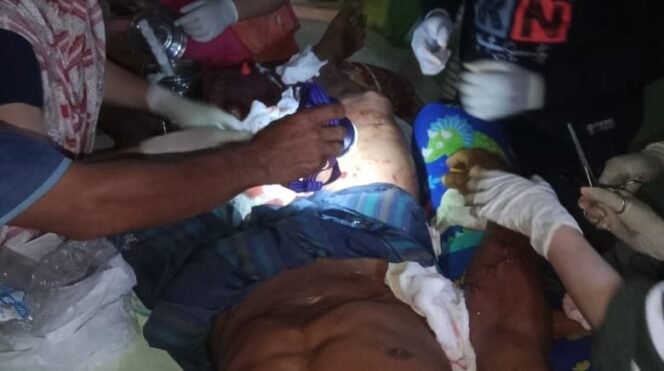 
 Kondisi tubuh Supri mengalami luka parah usai diterkam buaya. Foto: Istimewa