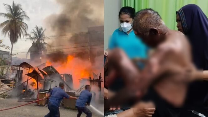 
 Petugas tengah memadamkan api (kiri) dan korban, Saldi (75) mengalami luka bakar di sekujur tubuhnya. Foto: Istimewa