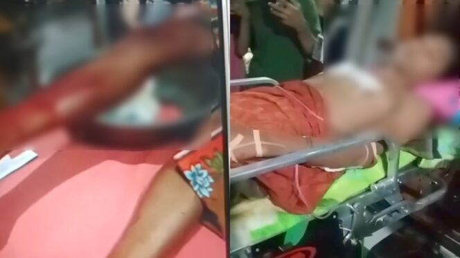 
 Remaja 17 tahun bernama Fedli menjalani perawatan medis usai diterkam seekor buaya di Sungai Kelurahan Watubangga Kolaka. Foto: Istimewa