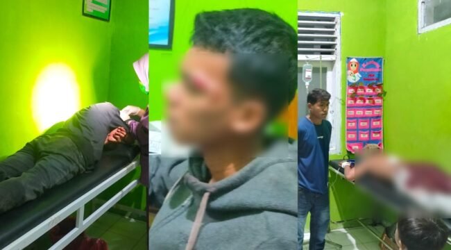 Tiga Pemuda terluka saat bentrokan acara coget di Sampolawa Busel. Foto: Istimewa