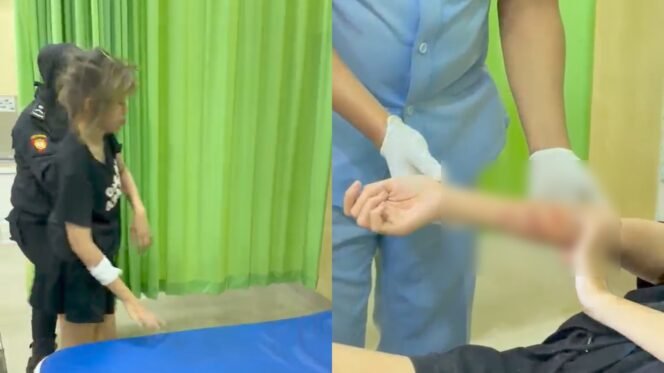 
 Seorang perempuan insial HR (18) dievakuasi di RS Bhayangkara Kendari setelah melukai tangannya sendiri. Foto: Istimewa