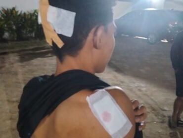 Seorang pemuda bernama Putra dibacok menggunakan parang di sebuah villa di Desa Tapulaga Konawe. Foto: Istimewa.