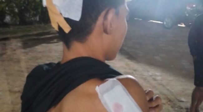 Seorang pemuda bernama Putra dibacok menggunakan parang di sebuah villa di Desa Tapulaga Konawe. Foto: Istimewa.