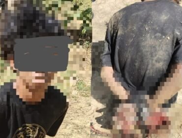 R (15) korban penganiyaan usai diduga hendak mencuri tabung gas. Foto: Istimewa