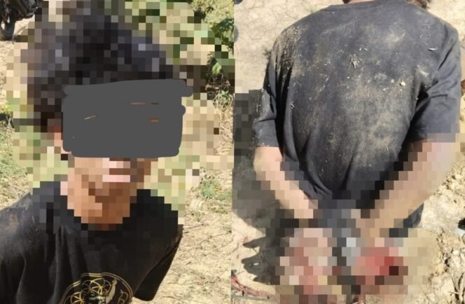 
 R (15) korban penganiyaan usai diduga hendak mencuri tabung gas. Foto: Istimewa