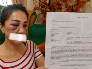 
Zherina Kei (korban) Warga Kecamatan Wuawua, Kota Kendari, melaporkan dugaan penganiayaan terhadap dirinya. Foto: Istimewa  