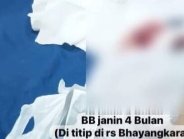 Barang bukti berupa janin usia 4 bulan yang diamankan di RS Bhayangkara Kendari. Foto: Istimewa