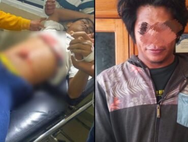 Pria bernama Rahim (kiri) mengalami luka parah pada bagian perut setelah diduga ditikam oleh pria insial M (kanan) saat nonton acara joget di Buton. Foto: Istimewa