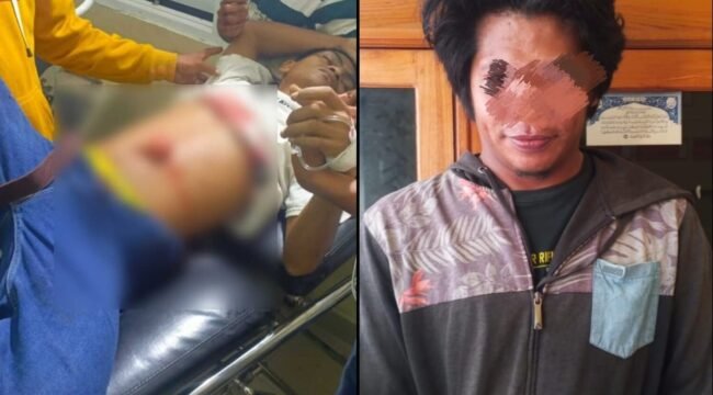 Pria bernama Rahim (kiri) mengalami luka parah pada bagian perut setelah diduga ditikam oleh pria insial M (kanan) saat nonton acara joget di Buton. Foto: Istimewa