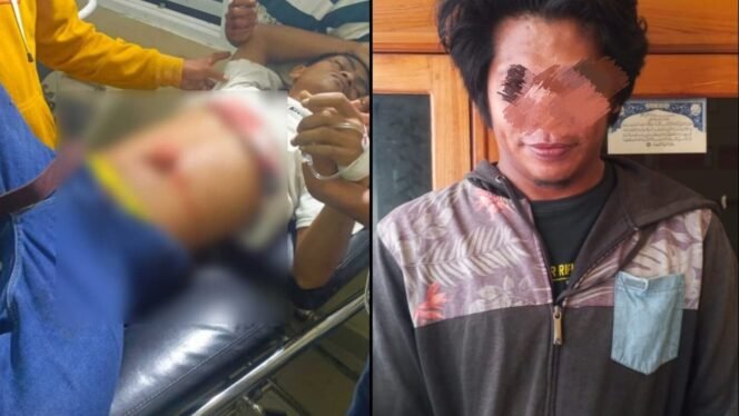 
 Pria bernama Rahim (kiri) mengalami luka parah pada bagian perut setelah diduga ditikam oleh pria insial M (kanan) saat nonton acara joget di Buton. Foto: Istimewa